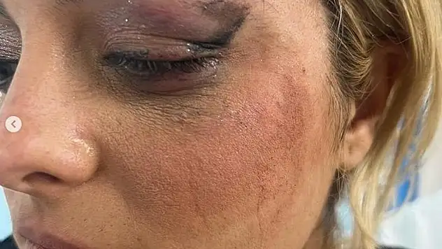 Bebe Rexha’ya sahnede telefonlu saldırı