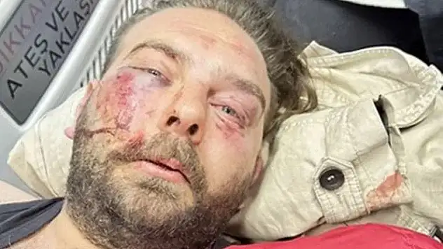 CHP Gençlik Kolları yöneticisine saldırı yapıldı