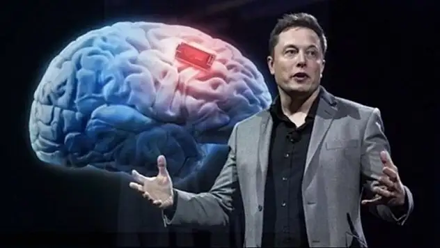 Elon Musk’ın beyin çipi projesi