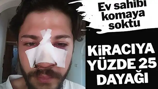 Şiddet bu sefer kiracıya!