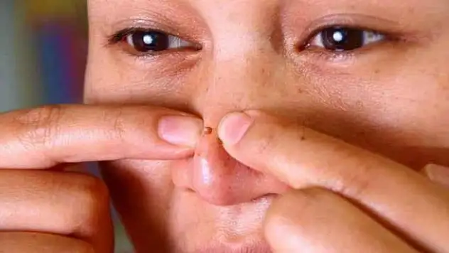 Sivilcelerden uzak durun!