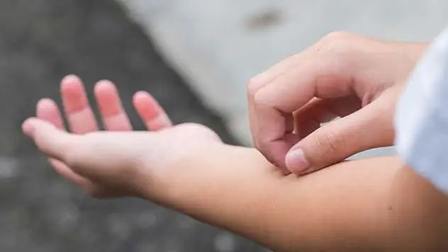 Uzmanlardan Vitamin Eksikliği Uyarısı: Belirtileri Göz Ardı Etmeyin