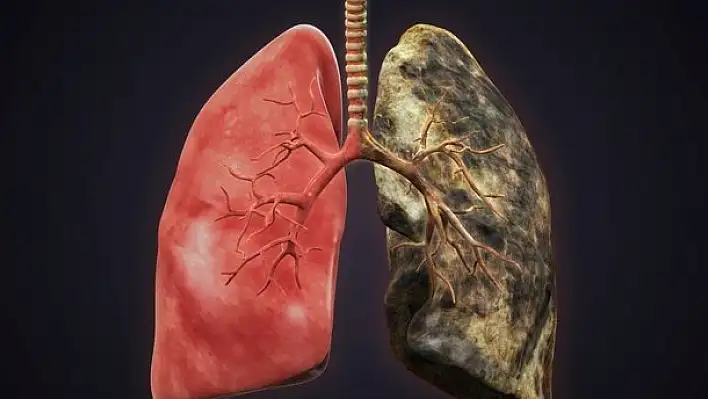 Akciğer sertleşmesi ölüme kapı açıyor